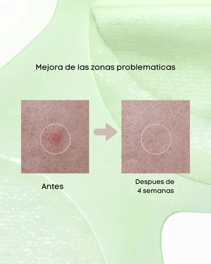 Azelaic 3 Cica Skin Clarifying Toner