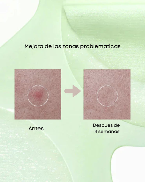 Azelaic 3 Cica Skin Clarifying Toner