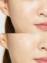 Cargar imagen en el visor de la galería, COSRX - Acne Pimple Master Patch (parches para brotes)
